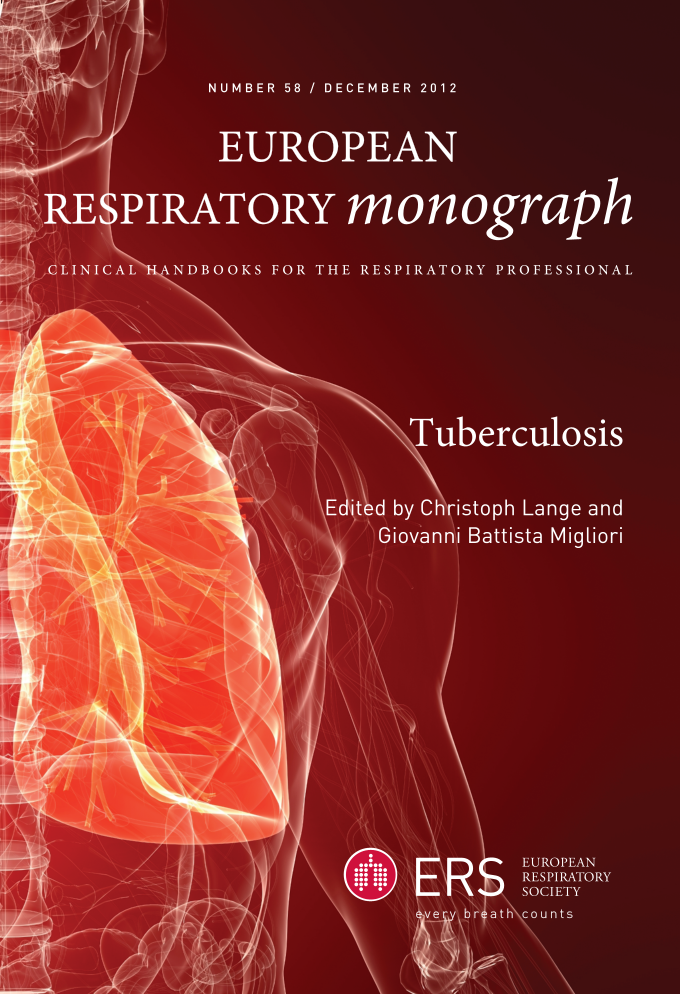 Tuberculosis (out of print) page Front cover1