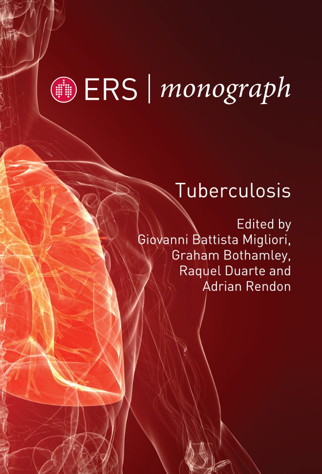 Tuberculosis page 1